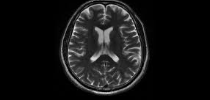 Advanced brain and spine imaging
