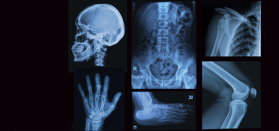 CT Angiography Imaging