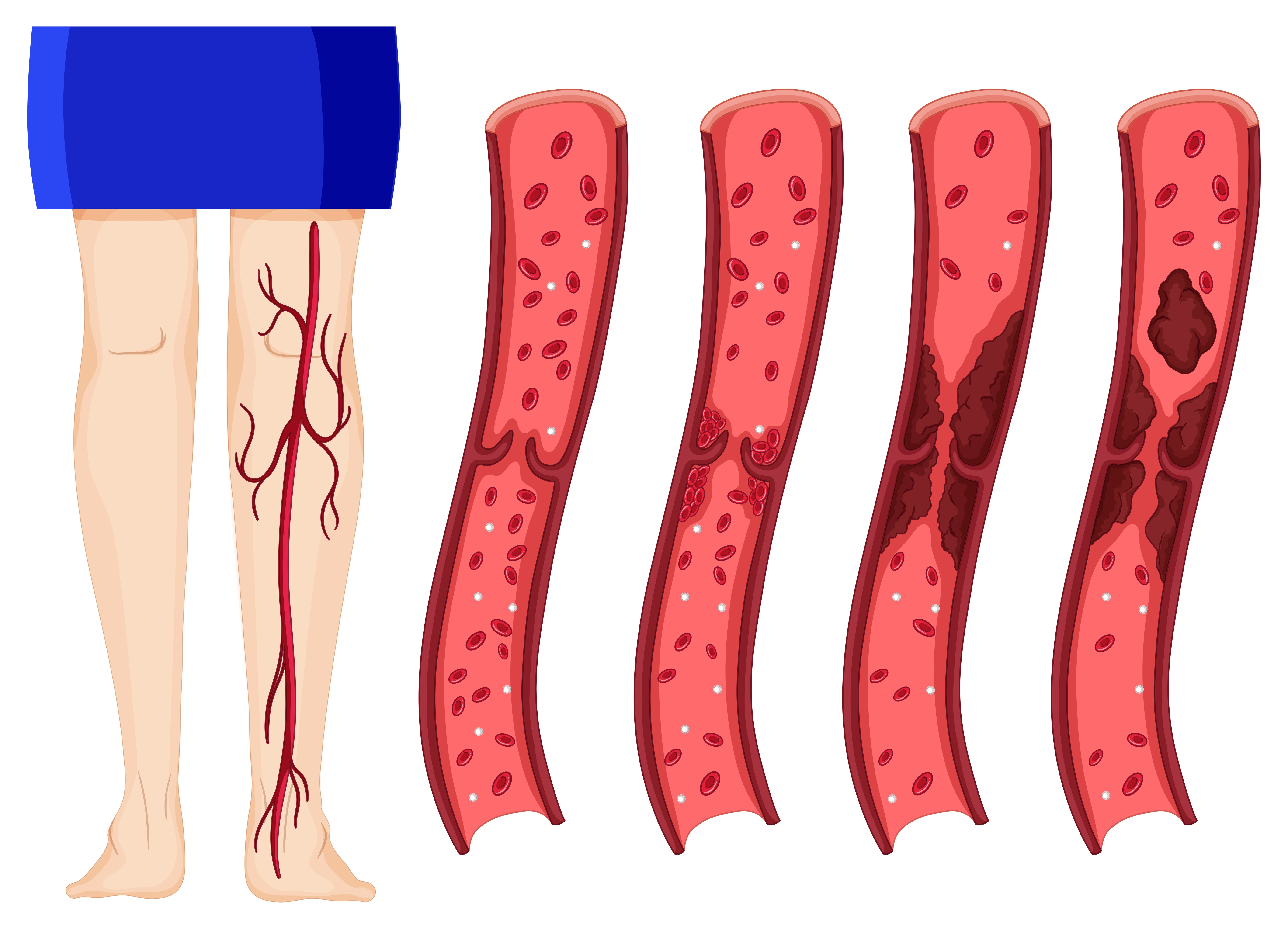 Vascular Imaging