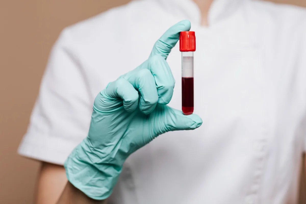Your Annual Bloodwork is Outdated: 5 Advanced Markers You Should Ask For in 2026