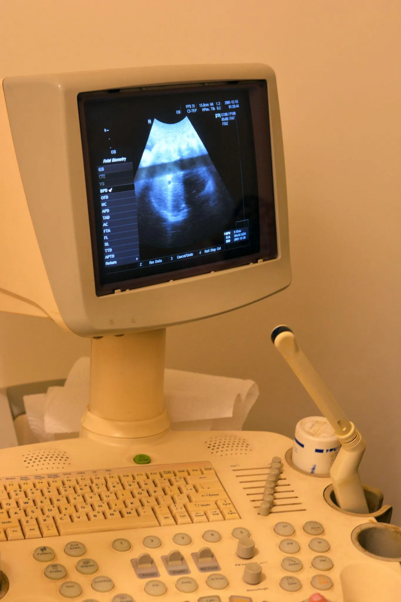 ultrasound