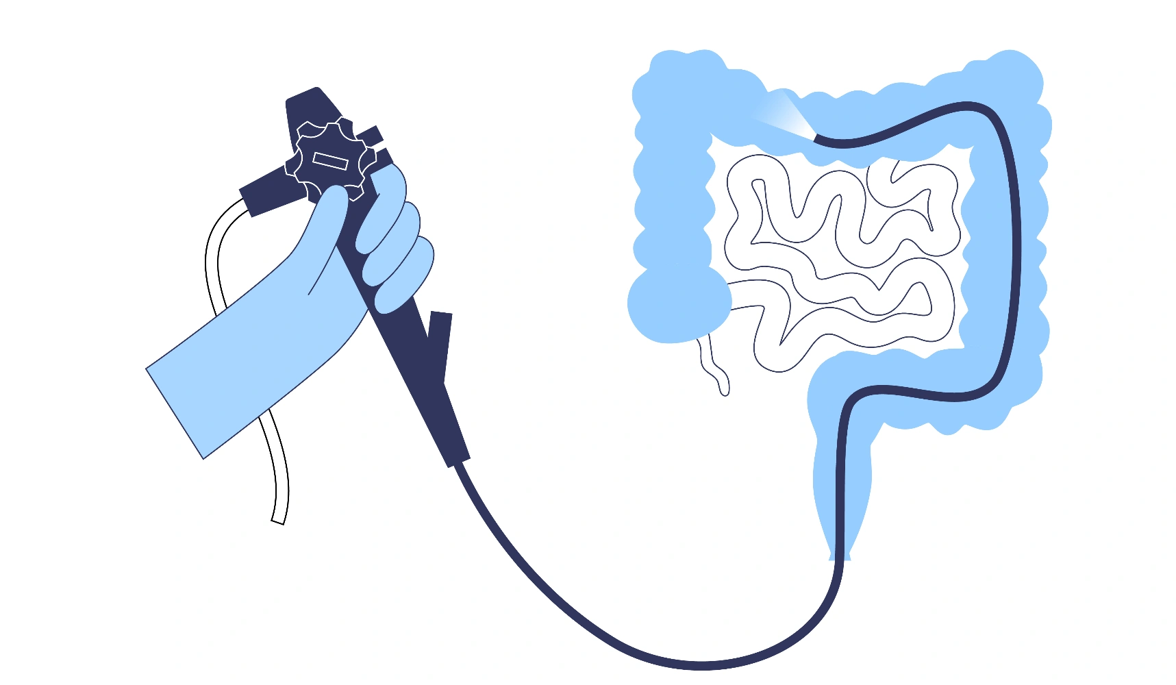 Sigmoidoscopy Banner