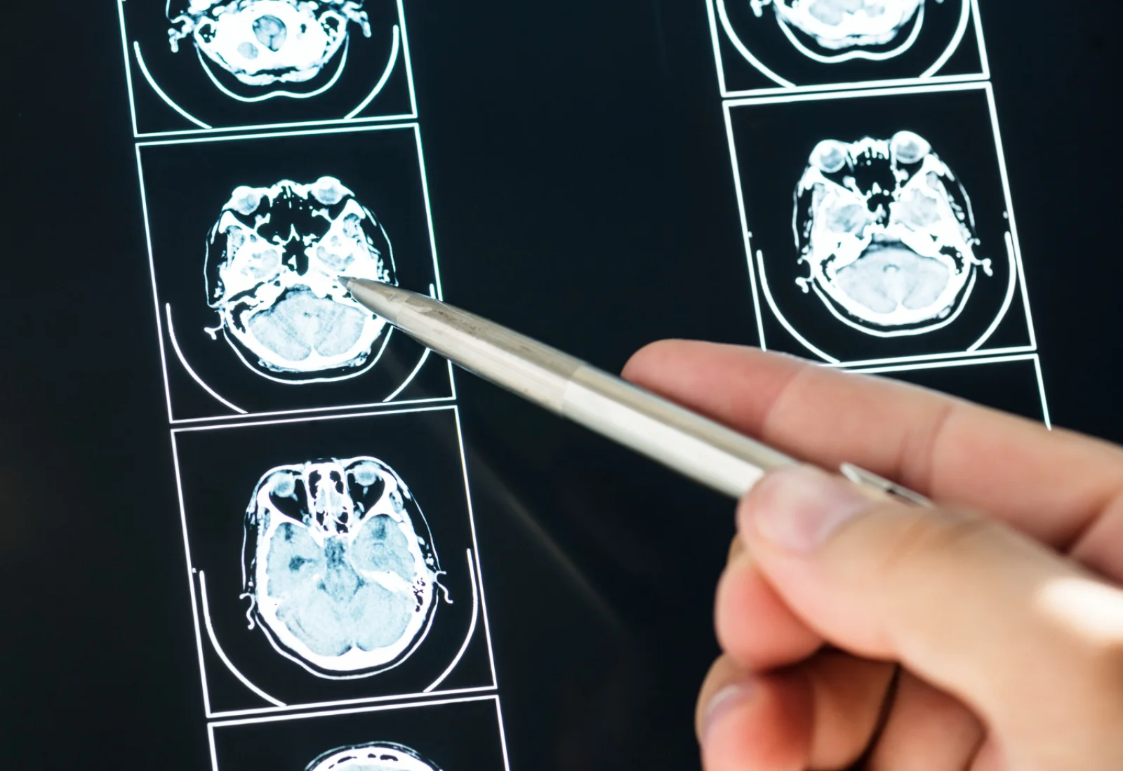 CT Scan Access for Sinus & Temporal Bone Banner