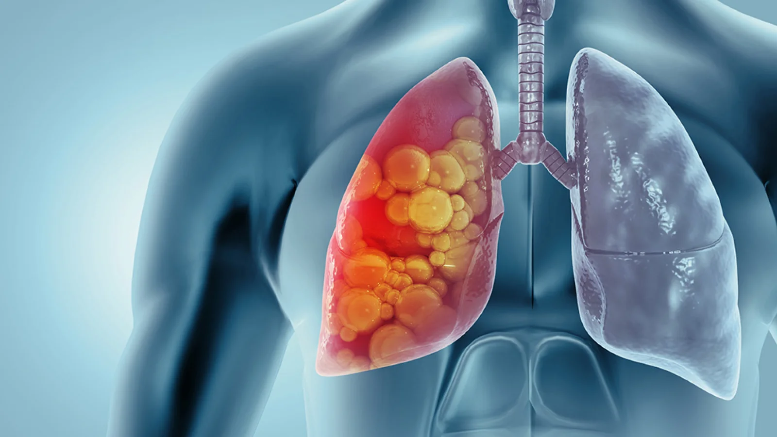Anti-Tuberculosis Therapy (ATT) Banner