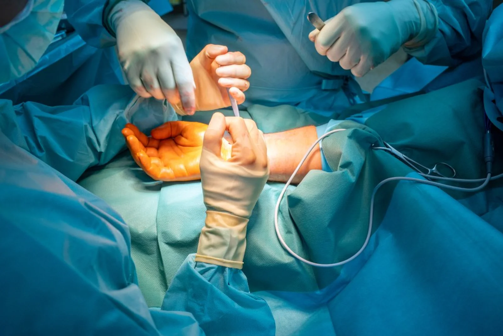 Arteriovenous Fistula Creation & Revision (for Hemodialysis) Banner