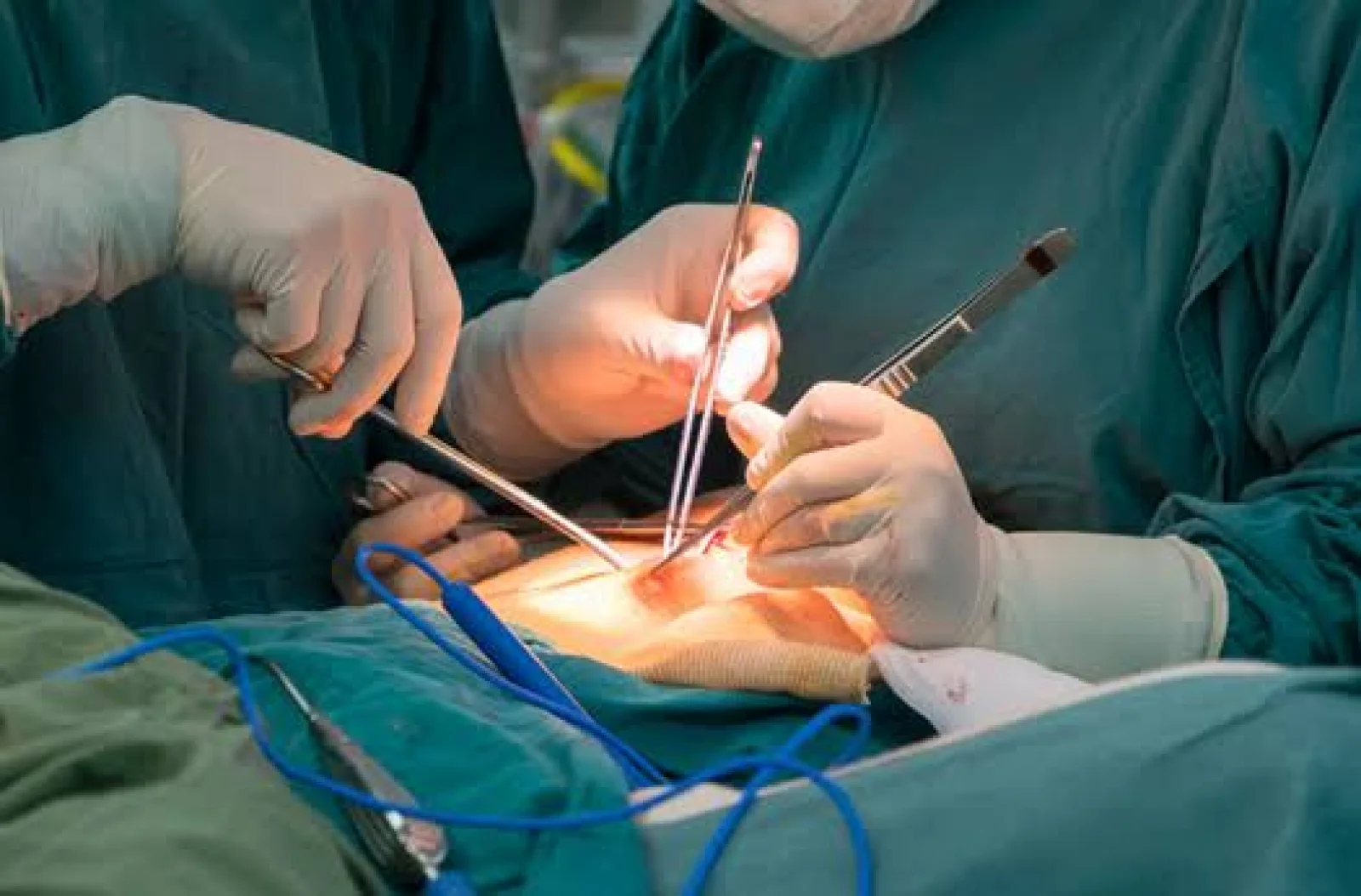 Best General Surgery hospital in Bangalore