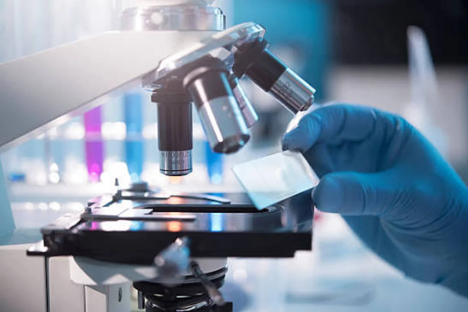 Best Pathology hospital in Bangalore